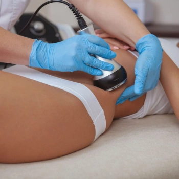 Zabieg wyszczuplająco antycellulitowy